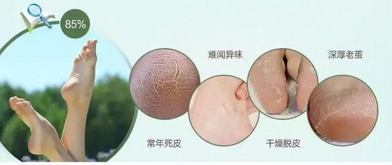 「芯迈足部小科普」老年人应该如何护理足部？一份全面的足部护理指南